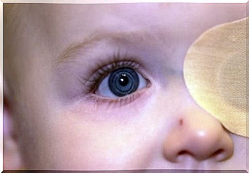 Babies can also have cataracts