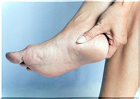 Calcaneus spurs - causes and treatment