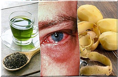 Home remedies for conjunctivitis