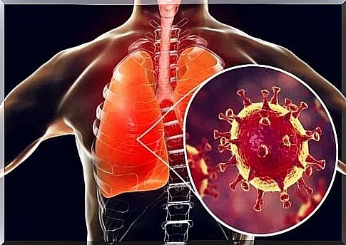 Pathogen that causes bronchitis