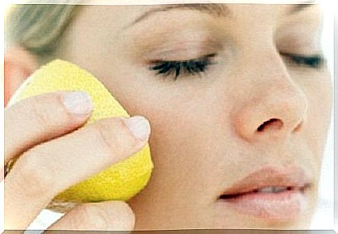 Natural remedies for lemon freckles