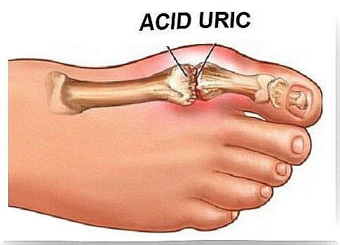 Uric acid