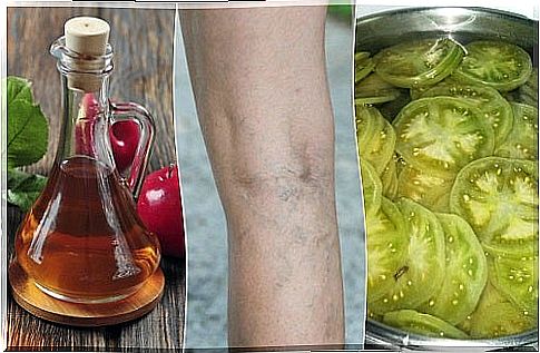 Natural remedy for varicose veins with vinegar and green tomatoes