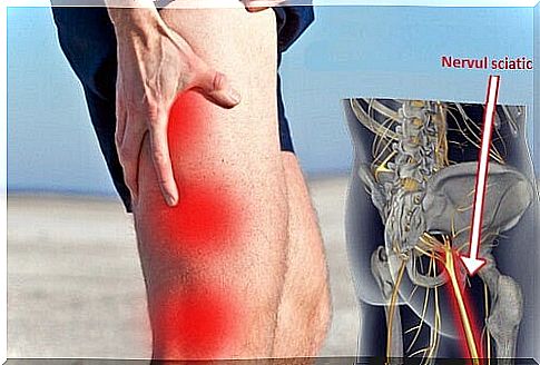 Natural treatments for sciatica - 9 options