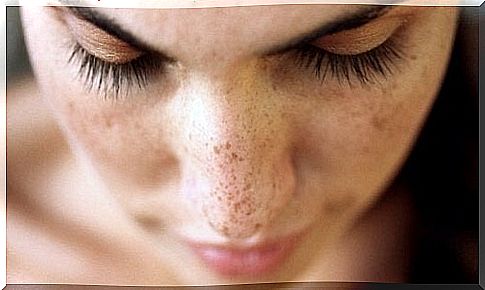 Remedies against blackheads and brown spots