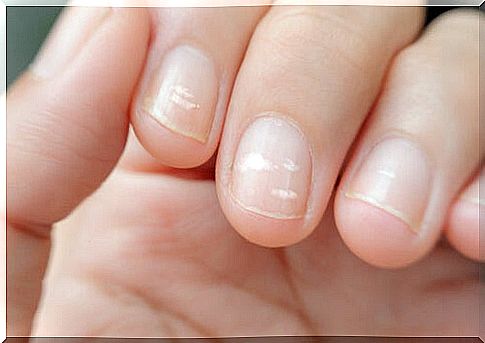 Removing stripes from zinc nails