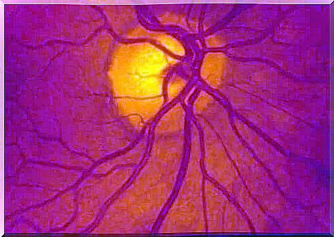 Retinal detachment: surgery