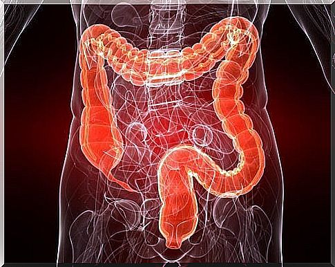 Ulcerative colitis: a disease still unknown